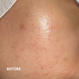 Honey Milky Treatment Essence