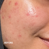 Celaney Fortifying Serum