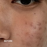Bulaney Treatment Essence