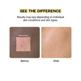 Bulaney Treatment Essence