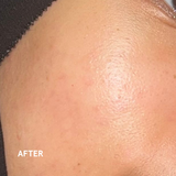 Honey Milky Treatment Essence